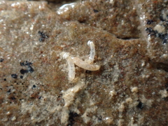 Caecum