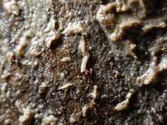 Caecum