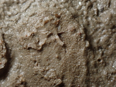 Caecum