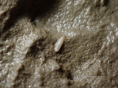 Caecum