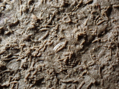 Caecum