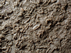 Caecum