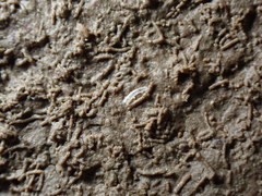Caecum