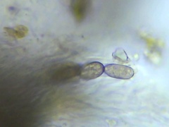 Leucodecton subcompunctum