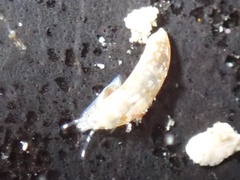 Caecum