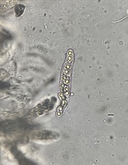 Dialonectria diatrypellicola