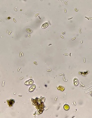 Dialonectria diatrypellicola