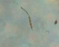 Nitzschia