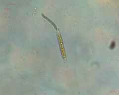 Nitzschia