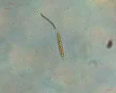 Nitzschia