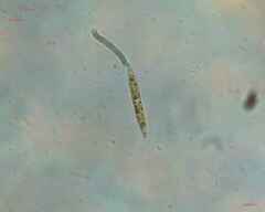Nitzschia