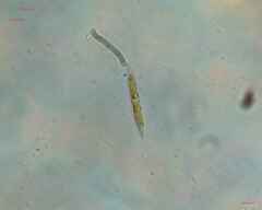 Nitzschia