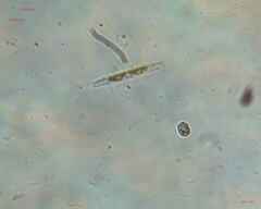 Trachelomonas