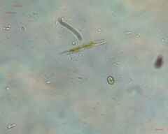 Trachelomonas
