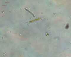 Trachelomonas