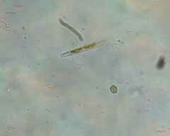 Trachelomonas