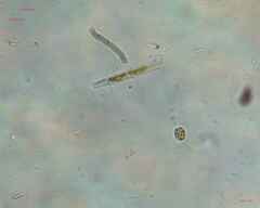 Trachelomonas