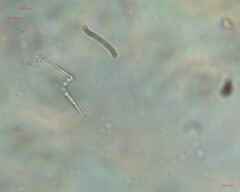 Cyanobacteria
