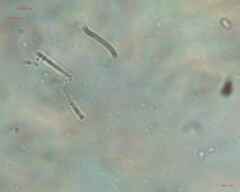 Cyanobacteria