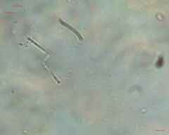 Cyanobacteria