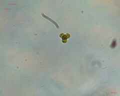 Chlorophyta