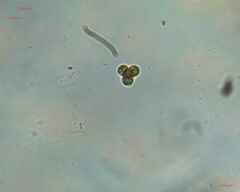 Chlorophyta