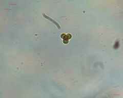 Chlorophyta