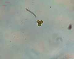 Chlorophyta