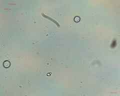 Fungi