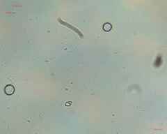 Fungi