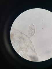 Ostracoda