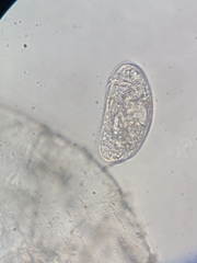 Ostracoda