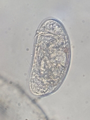 Ostracoda