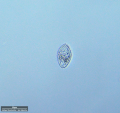 Ciliophora