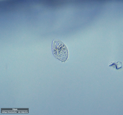 Ciliophora