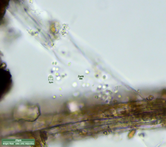 Bacteria