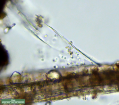 Bacteria
