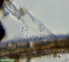 Bacteria