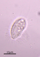 Cyclidium glaucoma