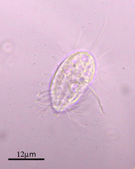 Cyclidium glaucoma