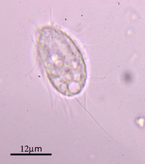 Cyclidium glaucoma