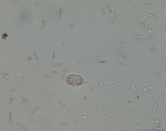 Dialonectria diatrypellicola