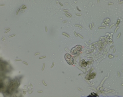 Dialonectria diatrypellicola