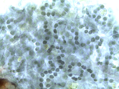 Scytinium lichenoides