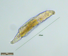 Philodina