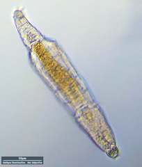 Philodina