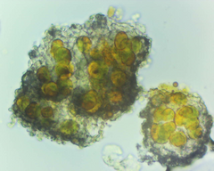 Nadvornikia sorediata