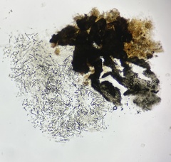 Delitschia marchalii