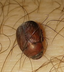 Maladera insanabilis