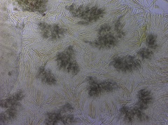 Chlorosplenium